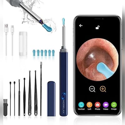 Oorsmeerverwijderaar met Camera 1080P HD – Slimme Oorreiniger met App – LED Oorendoscoop met 6 Siliconen Oorlepels & 8 Tools – Voor iOS & Android – Azuurblauw
