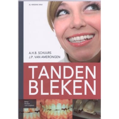 Tanden Bleken