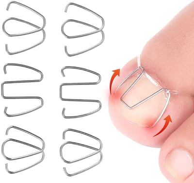 Dailygoods- Teennagelcorrector - Ingegroeide Teennagel Tool - Nagelcorrectie Haak - Draad Lifter - Recovery Tool - Geschikt voor Vrouwen/Mannen
