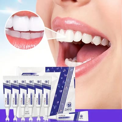 Tandbleek Gel Set – 7-delige Whitening Serum Kit voor Dagelijkse Tandverzorging – Veilige Tandenbleek Gel voor Mannen & Vrouwen – Voor Witte Tanden & Een Zelfverzekerde Glimlach – Eenvoudig Thuis te Gebruiken