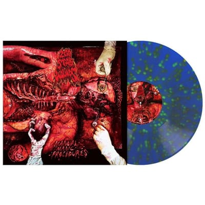 200 Stab Wounds - Manual Manic Procedures (blue, orange & green splatter vinyl)