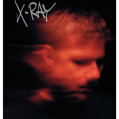 Murdock - X-Ray (2 LP)