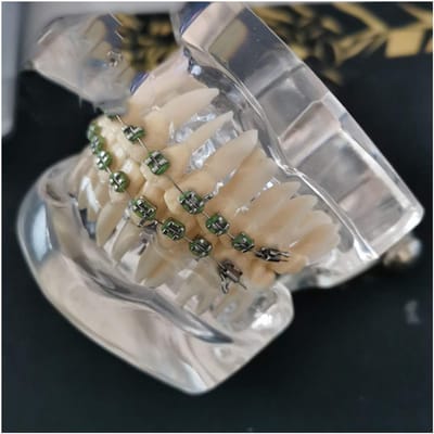 Tandenonderwijs Model - Orthodontisch Model - Tandheelkundig Onderwijs - Met Beugels - N.v.t. - Transparant