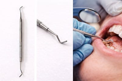 Belux Surgical Instruments - Dental Excavator – Dubbelzijdige Lepelcurette – Gebogen – RVS – Tandheelkundig Instrument