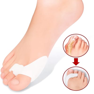 Siliconen Teencorrector I Teenspreider I Hallux Valgus I Grote en Kleine Teenbeschermer I 1 Paar