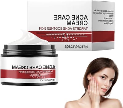 Anti-Pimple Crème voor Gezicht en Lichaam - Effectieve Behandeling tegen Acne, Puistjes en Mee-eters voor een Stralende Huid