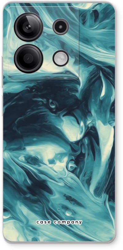 Case Company® - Hoesje geschikt voor Xiaomi Redmi Note 13 5G hoesje - Dreaming About Whales - Soft Cover Telefoonhoesje - Bescherming aan alle Kanten en Schermrand