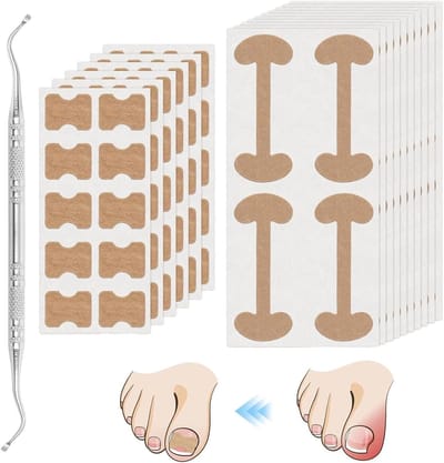 Ingegroeide teennagelbehandeling inclusief 2 soorten teennagelpleisters en professionele ingegroeide teennagelcorrectie