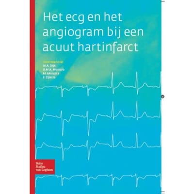 Het Ecg En Het Angiogram Bij Een Acuut Hartinfarct - W.A. Dijk