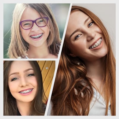 10 Stuks Orthodontische Elastische Verwijderingstools voor Beugels - Plastic Haken, Elastische Touwtjes en Plaatsingshulpmiddelen voor Tandheelkunde