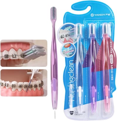 Orthodontische Tandenborstel - Beugelborstel Set - Tanden Reinigen - Speciaal Concaaf Ontwerp - 3 Stuks - Blauw