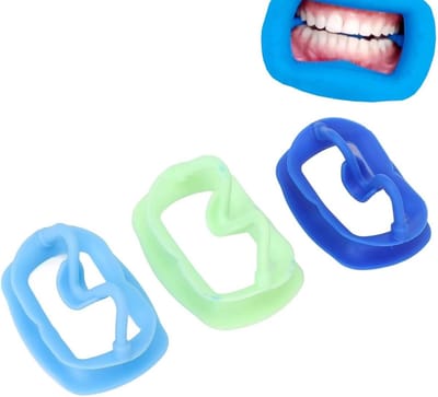 Set van 3 Silicone Wangen Retractoren, Intraorale Mondopeners voor Tandheelkundige Toepassingen, Ideaal voor Tanden Bleken en Tandartsbezoeken
