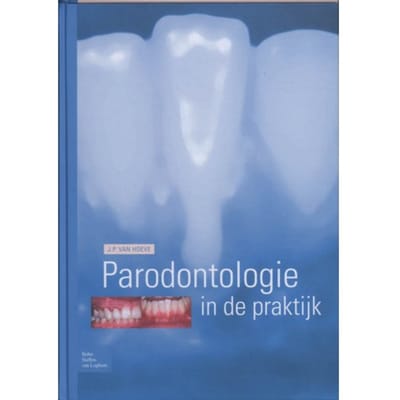 Parodontologie In De Praktijk - J.P. van Hoeve
