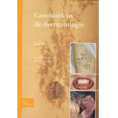 Casuïstiek In De Dermatologie - Johan Toonstra