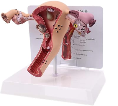 Baarmoeder Model - Anatomisch Model - Medische Training - Gedetailleerde Weergave - 18x15x8cm - Veelkleurig