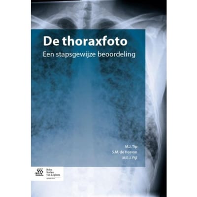 De Thoraxfoto - M.J. Tip