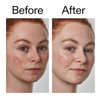 The INKEY List Super Solutions Serum 10% Azelaïnezuur 30 ml