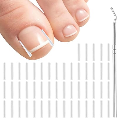51-delige set voor het corrigeren van ingegroeide teennagels - pijnloze nagelcorrectie en nagelverzorging