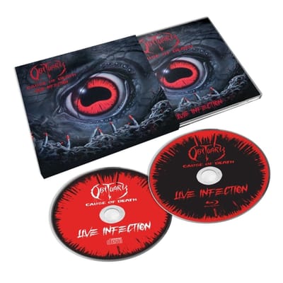 Cause Of Death: Live Infection - Obituary