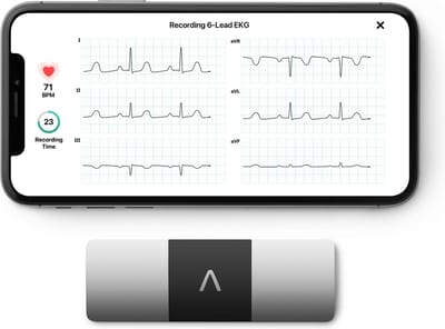 KardiaMobile 6-afleidingen ECG-hartslagmeter – Medisch goedgekeurd en klinisch getest – Geavanceerd draagbaar ECG voor smartphones – Betrouwbaar Detectie van boezemfibrilleren en hartritmestoornissen