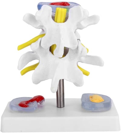 Allecto - Menselijk lumbale wervelmodel - Anatomisch skeletmodel