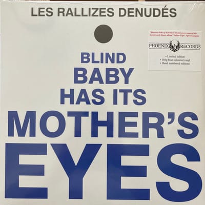 Blind Baby Has Its Mothers Eyes