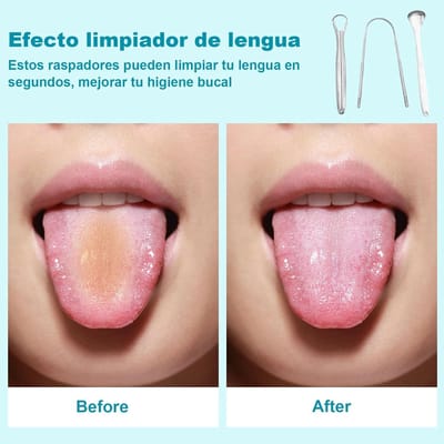 Tong Reiniger - Adem Verfrisser - Mondhygiëne Verbeteren - Roestvrij Staal - 18 cm - Zilver