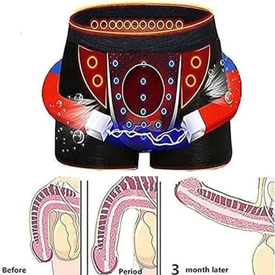 Heren Magnetische Therapie Boxershorts - 5-Pack Prostaat Therapie Slipje