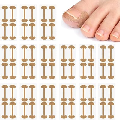 80 stuks set voor ingegroeide teennagels, teennagelcorrectie, pleisterpatch voor ingegroeide teennagel voor het behandelen van ingegroeide teennagels