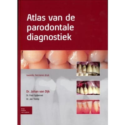 Atlas Van De Parodontale Diagnostiek - Johan van Dijk