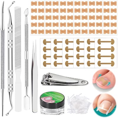 Dailygoods- Teennagelset 139 Stuks - Teennagelcorrectieset - Ademend - Nagelverzorgingsstrips - Nagelknipper - Veiligheidswaarschuwing Ja - Nagelcorrectieset