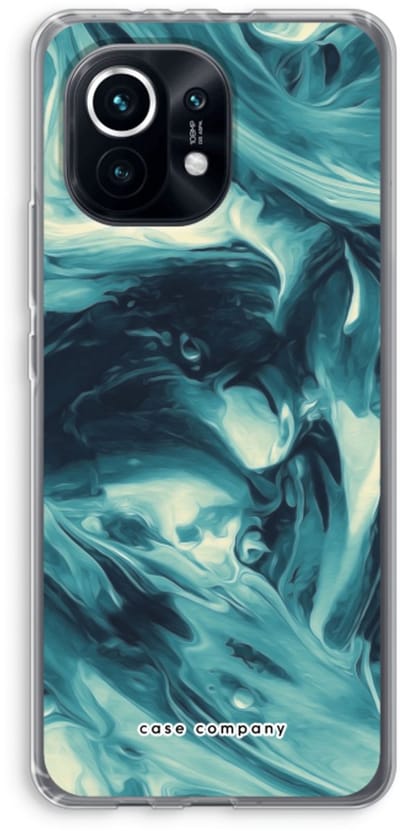 Case Company® - Hoesje geschikt voor Xiaomi Mi 11 hoesje - Dreaming About Whales - Soft Cover Telefoonhoesje - Bescherming aan alle Kanten en Schermrand