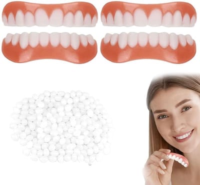 KARZO - paar valse tanden, veneers, fineertanden, cosmetische tand opgelost, cosmetische tand opgelost, namaak, tijdelijke tandprothese met tandreparatiekralen, tand opgelost