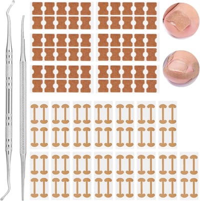 Set voor het Corrigeren van Ingegroefde Teennagels met 2 Soorten Patches, Nagelpen en Professionele Hulp bij Paronychia en Zachte Teennagels