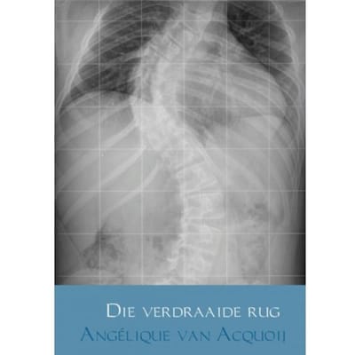 Die Verdraaide Rug - Angelique van Acquoij