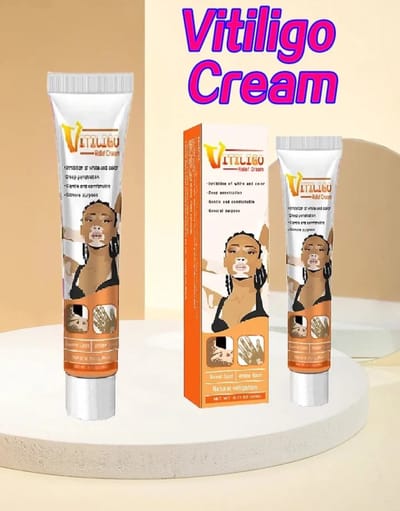 2 stuks zeer effectieve vitiligo creme en lamp, soriasis anti bacteriële creme helpt vitiligo te verminderen / verwijderen. Anti vlekken creme