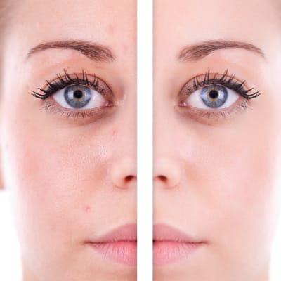 CORRECTOR MINT Kleur: Groen Doel: corrigeert roodheid, couperose, rode vlekjes en rosacea
