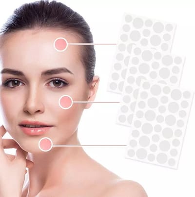 Pimple patches - Acne patches - Pimple patch - puisten pleisters - acne pleister - 108 stuks