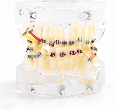 Orthodontische modellen voor tandheelkundig onderwijs | Protheses en implantaten voor defectonderzoek | Beugels en draadketens voor orthodontische behandelingen