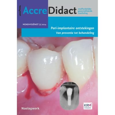 Peri-Implantaire Ontstekingen - Accredidact - Yvonne de Waal