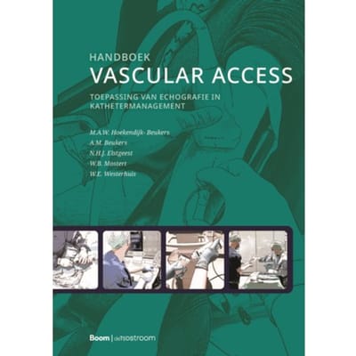 Handboek Vascular Access - M.A.W. Hoekendijk- Beukers