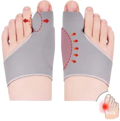 Teen Spreider Hallux Valgus Corrector – Orthese Teenenscheider voor Bunion Correctie, Botknobbel Behandeling & Pijnverlichting – Voetbeschermer en Pedicure Hulpmiddel