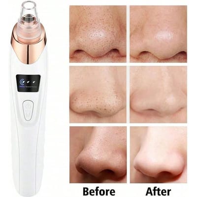 Nettoyeur de pores électrique 5 niveaux d'aspiration Extracteur de points noirs Aspirateur Élimination de l'acné Pour les pores profonds du visage Soins de la peau blanc