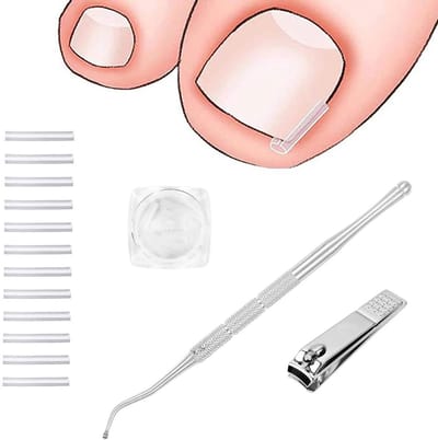 Set geschikt voor het corrigeren van ingegroeide teennagels - 50 pijnloze correctiepleisters geschikt voor teennagels, inclusief een teennagellifter - Eenvoudige set geschikt voor het corrigeren van ingegroeide teennagels