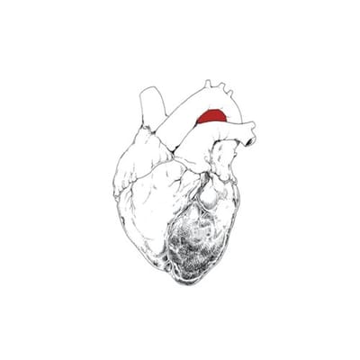 Beggar - Swans