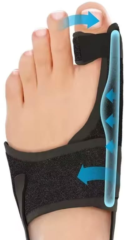 Hallux Valgus Corrector - Linkervoet - Scheve Grote Teen - Spalk - Brace - Links