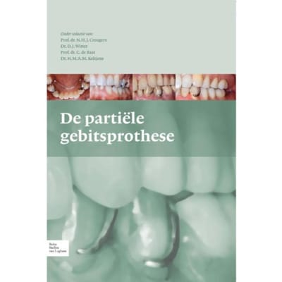 De Partiele Gebitsprothese - N.H.J. Creugers