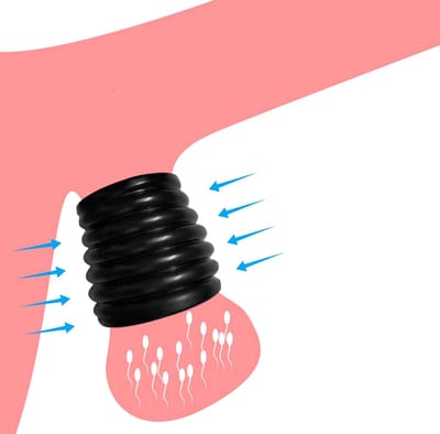 Fijne siliconen balzak ring - Ejaculatie vertragend - Scrotum stretcher - One size - Cockring