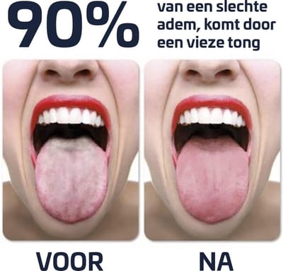 Effectieve Tongschraper - Tongreiniger - Rose Goud