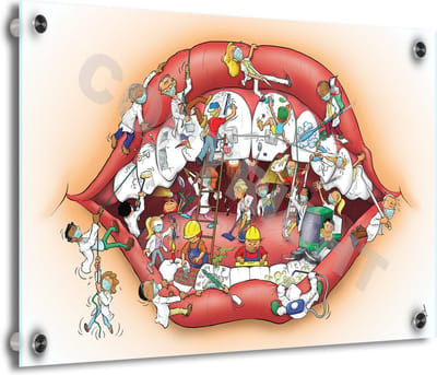Tandarts Cartoon op plexiglas - Uniek ontwerp - Roland Hols - Mond - 30 x 40 cm - 5 mm dik - inclusief 4 afstandhouders chroom (zilverkleurig) - Decoratie - Orthodontist - Mondhygiënist
